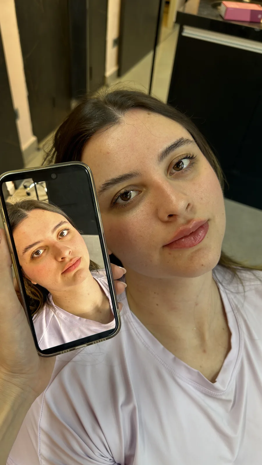 Paciente após o preenchimento labial segurando a foto de antes no celular